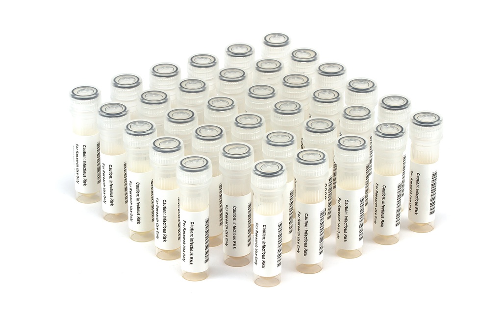 HBV11013 HBV Seroconversion Panel Donor n. 67962