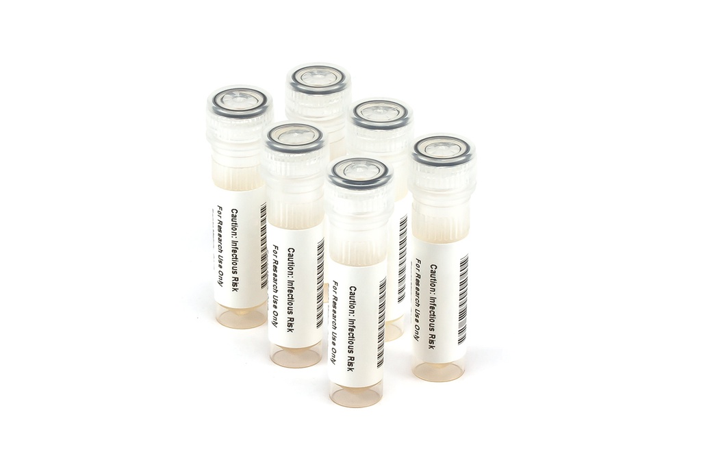 HIV9013 HIV Seroconversion Panel Donor n. 65404 (6x 1ml)