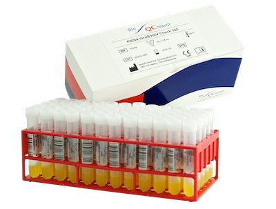 P0318-03 ViraQ HIV-2 Check 125