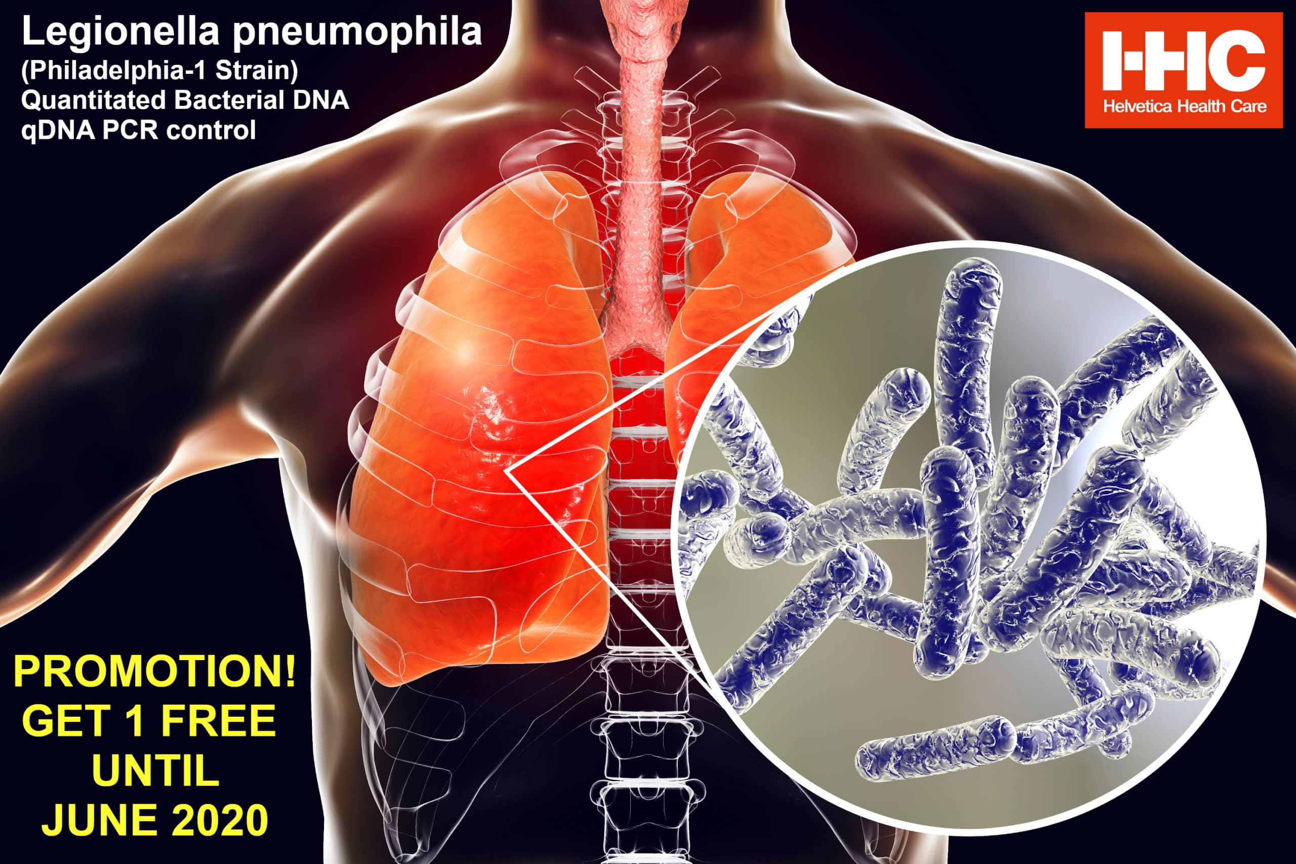 Legionella  Legionella Microbewiki  Legionella pneumophila is a gram