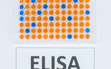 Top 5 criteria for selecting your ELISA kits