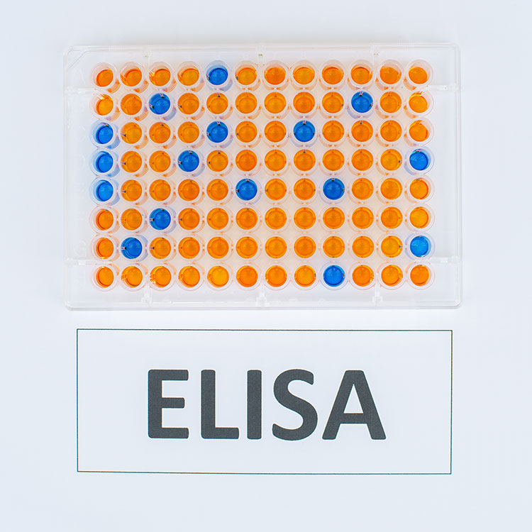 Top 5 criteria for selecting your ELISA kits