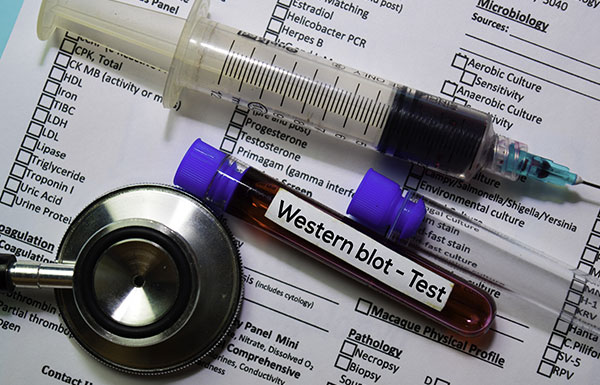 Difference between line blots and Western blots