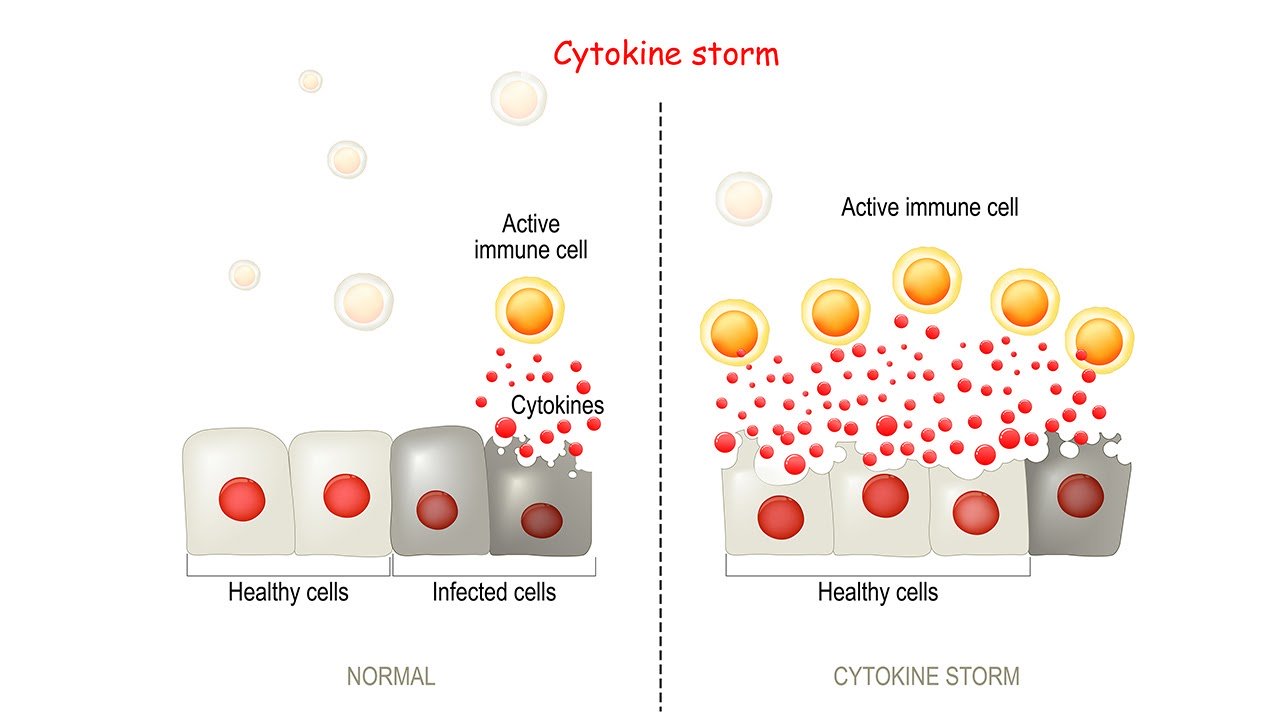 All You Need to Know about the COVID-19 Cytokine Storm