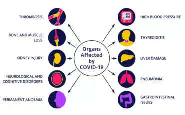 What are the organs most affected by COVID‐19?