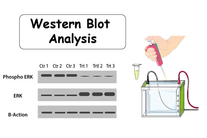 Western Blot Procedures, Analysis and Purpose