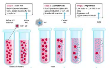 What are the phases of the HIV timeline?