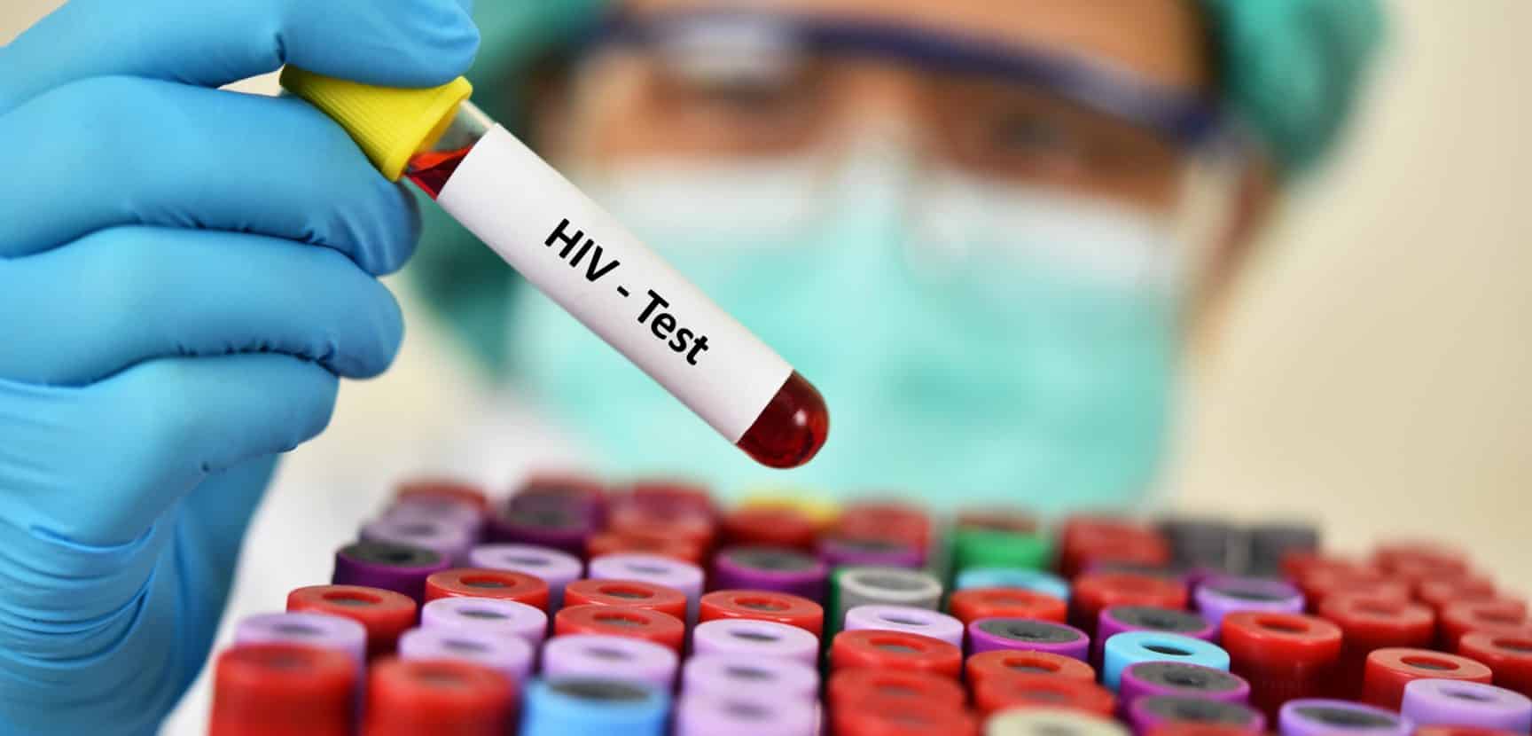 Seroconversion Panels vs. Standard HIV Tests: What's the Difference?